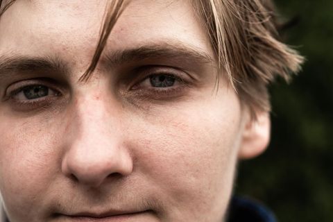 "Ich habe die Zombie-Droge überlebt. Das können nicht viele sagen"