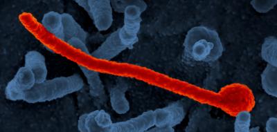 Ebola-Verdachtsfall löst in Tschechien Großeinsatz aus