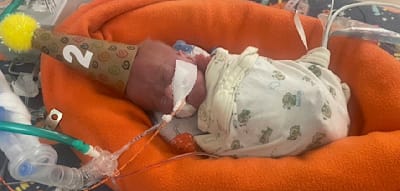 Er wog kaum mehr als ein Stück Seife, jetzt hält der kleine Nash einen Weltrekord