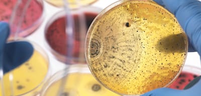 Tausende Tote in Deutschland, weil Antibiotika nicht mehr wirken
