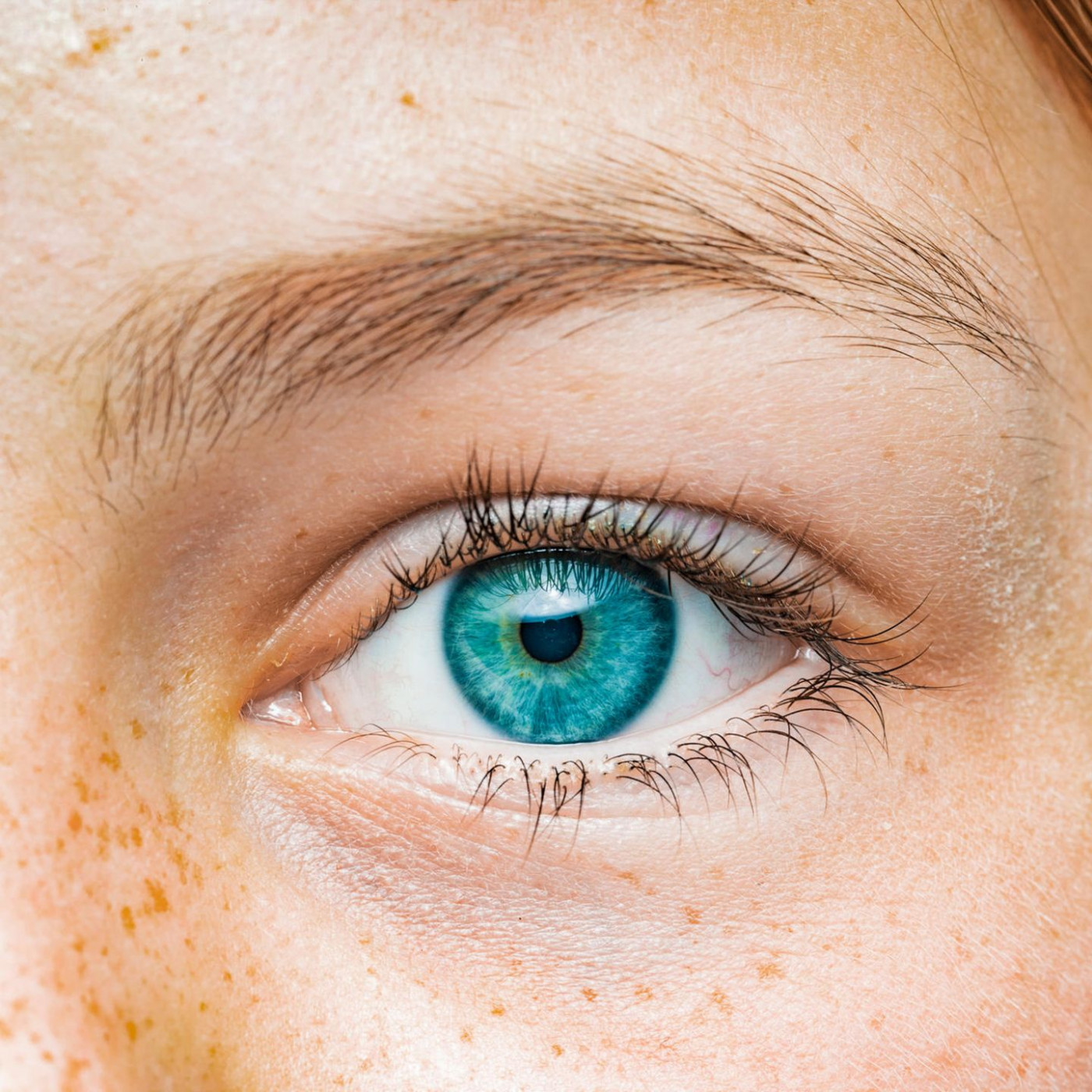 Was steckt hinter dem nervigen Zucken am Auge?