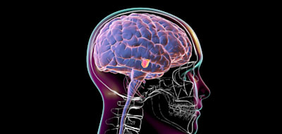„Bemerkenswerte Genauigkeit“ – ein Ultraschallhelm soll künftig gegen Parkinson helfen