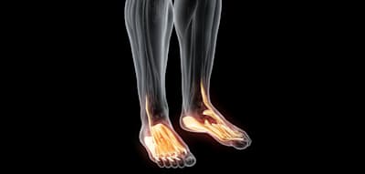 Krafttraining sollte barfuß gemacht werden – maximal mit Socken