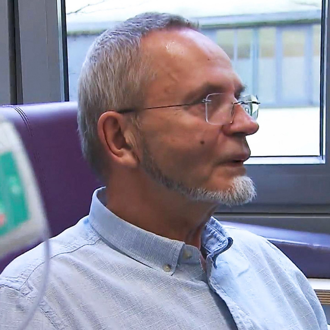 Neuartige Alzheimer-Behandlung – Antikörper-Infusion bekämpft Ursache im Hirn