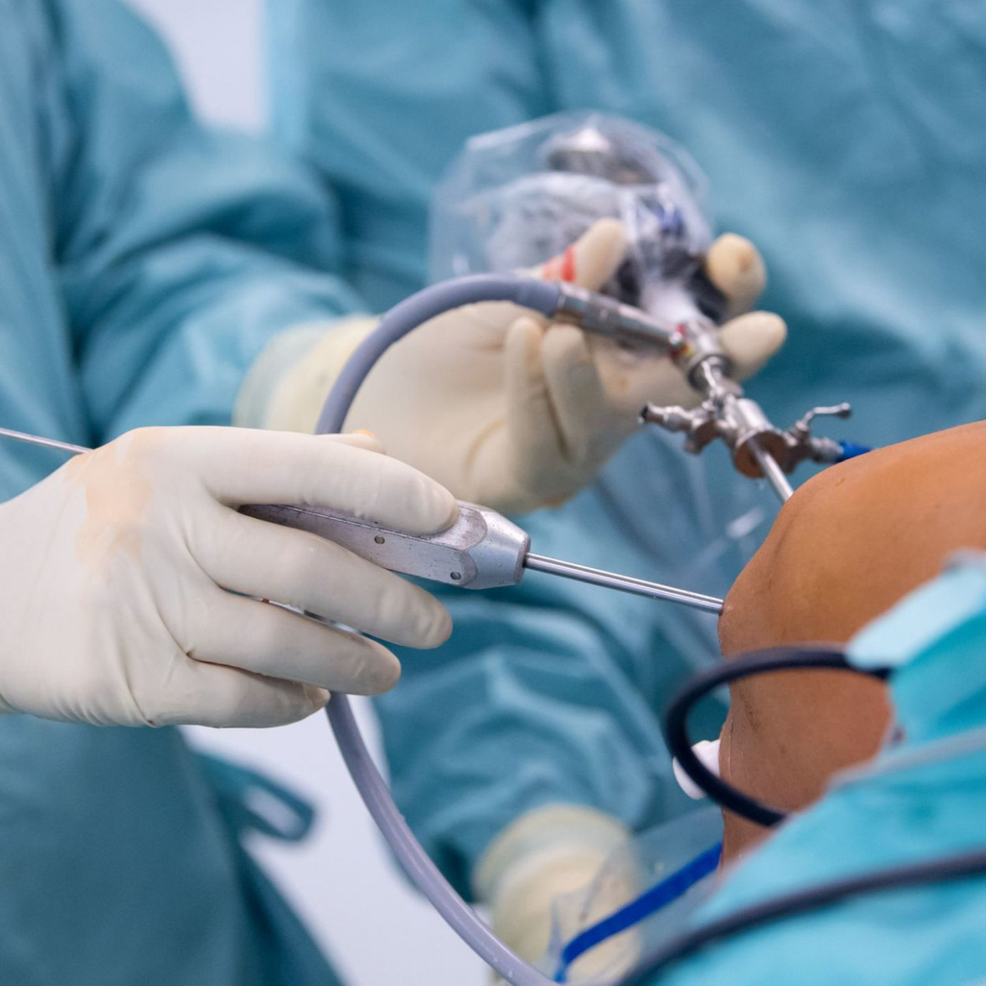 Kassen-Gutachter ermitteln rund 3.700 Behandlungsfehler