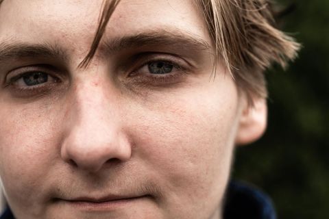 "Ich habe die Zombie-Droge überlebt. Das können nicht viele sagen"