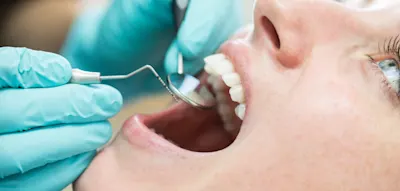 Forscher entwickeln weltweit erstes Gel, das Zahnschmelz wieder wachsen lässt