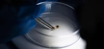 Neue Ermittlungsmethode &ndash; Forscher wollen Mordf&auml;lle k&uuml;nftig mit Bettwanzen l&ouml;sen