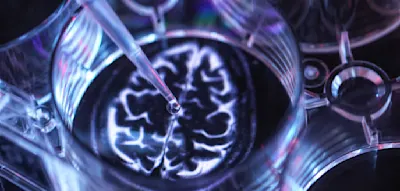 &bdquo;Wir sehen immer wieder ein starkes Schutzsignal f&uuml;r Demenz&ldquo;