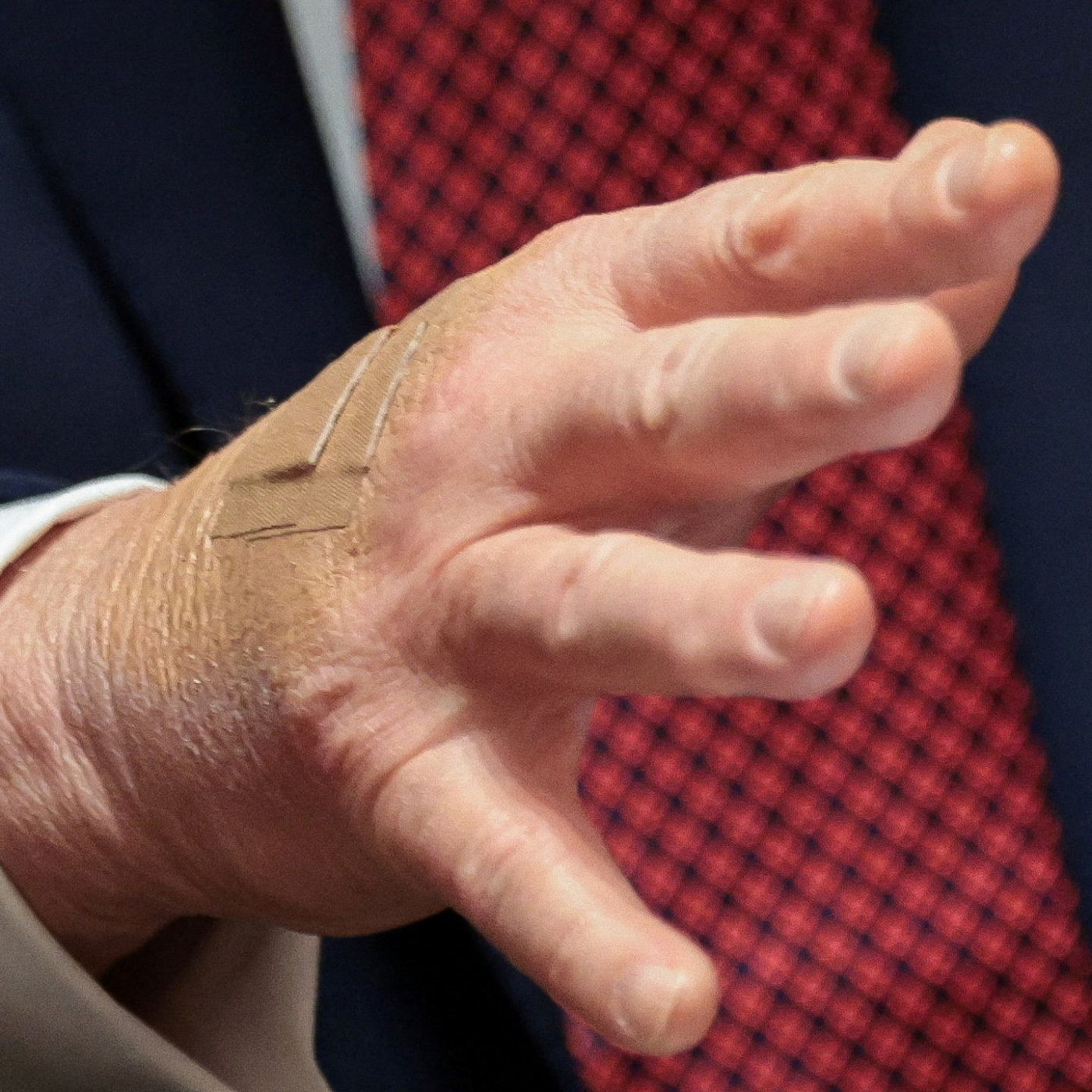 Schon wieder Pflaster an Trumps Hand: Wei&szlig;es Haus nennt Grund