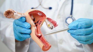 Mehr Forschung und Ausbildung zu Wechseljahren bei Frauen