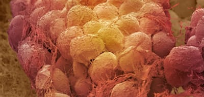 Menschen nehmen nach Abnehmspritze schneller zu als nach Di&auml;t