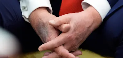 &bdquo;In vollem Umfang seinem Amt gewachsen&ldquo; &ndash; Merz widerspricht Zweifeln an Trumps Gesundheit