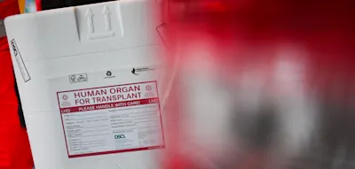 Drama bei Herztransplantation &ndash; Mediziner verwenden falsches Eis