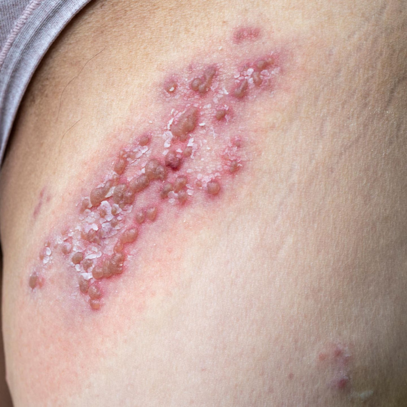 Krankheiten, die man nicht haben muss