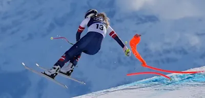 &bdquo;Der Arzt hat mein Bein vor der Amputation bewahrt&ldquo;