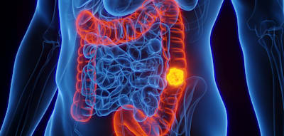 &bdquo;Dieser Nutzen ist mit unmittelbaren Risiken verbunden&ldquo;