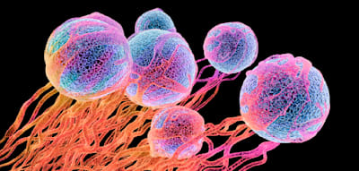 Forscher stellen vielversprechendes Medikament gegen Prostatakrebs vor