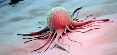 Vegetarier und Veganer weisen bei zwei Krebsarten ein deutlich h&ouml;heres Risiko auf