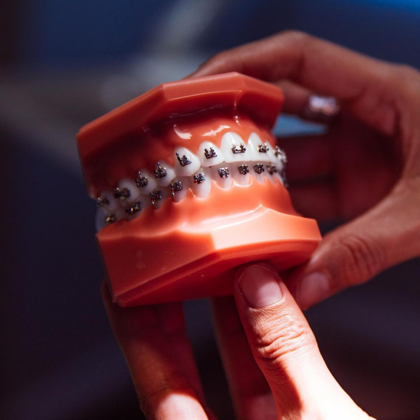 Deshalb muss der Zahnspangenwahn endlich ein Ende haben