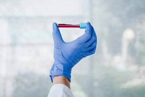 Gut vorbereitet zum Arzt: So ordnen Sie Blutwerte richtig ein