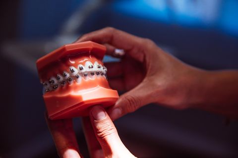 Deshalb muss der Zahnspangenwahn endlich ein Ende haben