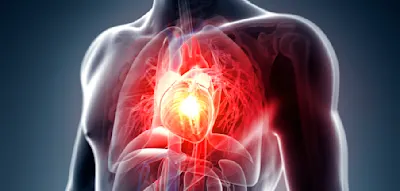 Herzkrank durch Essen &ndash; diese Lebensmittel kosten jedes Jahr Millionen Leben