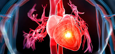 &bdquo;Kardiovaskul&auml;re Sterblichkeit wird zu einem gro&szlig;en Teil durch Infektionen getriggert&ldquo;