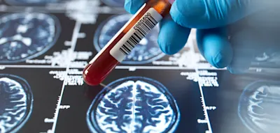 &bdquo;Das st&auml;rkt die Evidenz, dass die Darm-Hirn-Achse beim kognitiven Altern wichtig ist&ldquo;