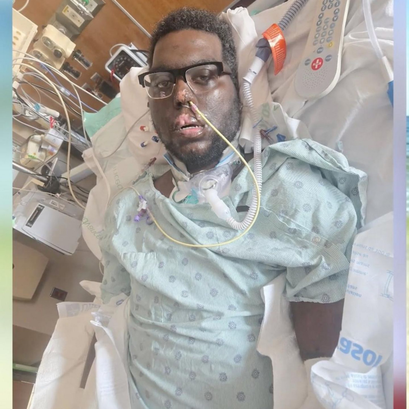 Zahnbehandlung f&uuml;hrt zu Blutvergiftung &ndash; 34-J&auml;hriger verliert Extremit&auml;ten