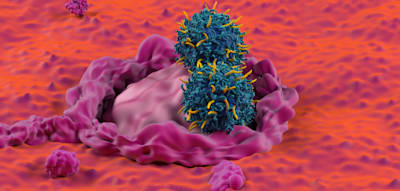 Forscher weisen erh&ouml;htes Krebsrisiko bei M&auml;nnern mit schlechter Spermienqualit&auml;t nach