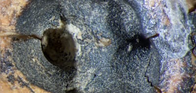 Neandertaler nutzten offenbar Steinbohrer, um faulen Zahn zu behandeln