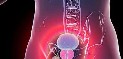 Bluttests, um Prostatakrebs zu erkennen? &bdquo;Absoluter Nutzen ist gering&ldquo;
