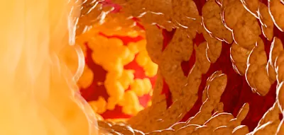 Dieser vererbbare Blutwert zeigt erh&ouml;htes Herzrisiko an &ndash; ein Test gen&uuml;gt