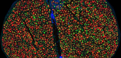 Wissenschaftler ver&ouml;ffentlichen weltweit erste anatomische Karte des Vagusnervs