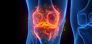 Warum Stress bei manchen Menschen Arthritis ausl&ouml;st und bei anderen nicht