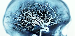 Diese Cholesterin-Senker haben einen unerwarteten Nebeneffekt
